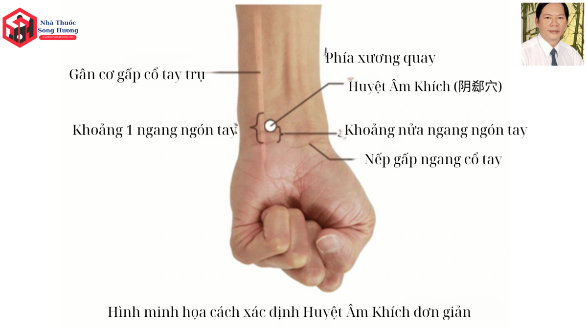 Huyệt Âm Khích vị trí giải phẫu trên bàn tay