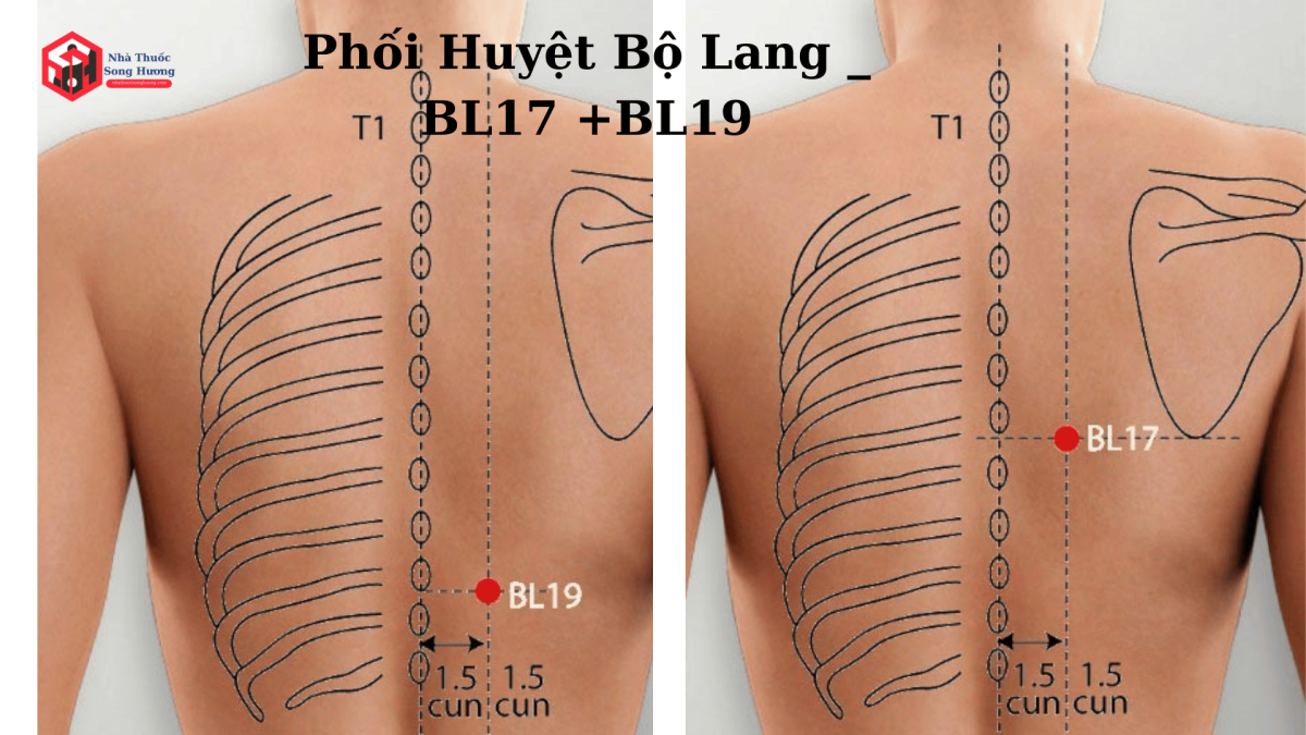 bộ lang và bl17 bl19 trị đau thần kinh liên sườn