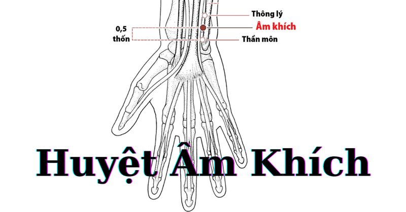 câu hỏi thường gặp về huyệt âm khích