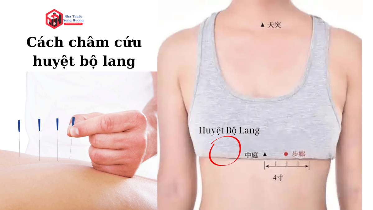 huyệt bộ lang nằm ở sườn 5, cách đường giữa ngực 2 thốn. Châm cứu sao hiệu quả