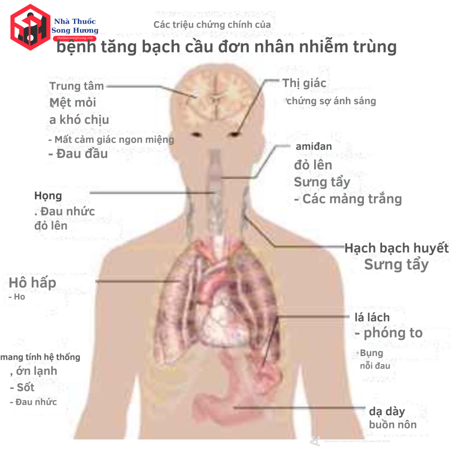 Amidan to có mảng trắng kèm sưng hạch cổ