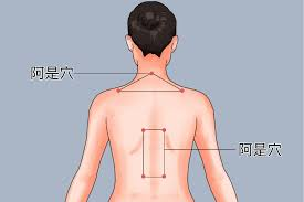 Tên “a thị” bắt nguồn từ phản xạ kêu “a