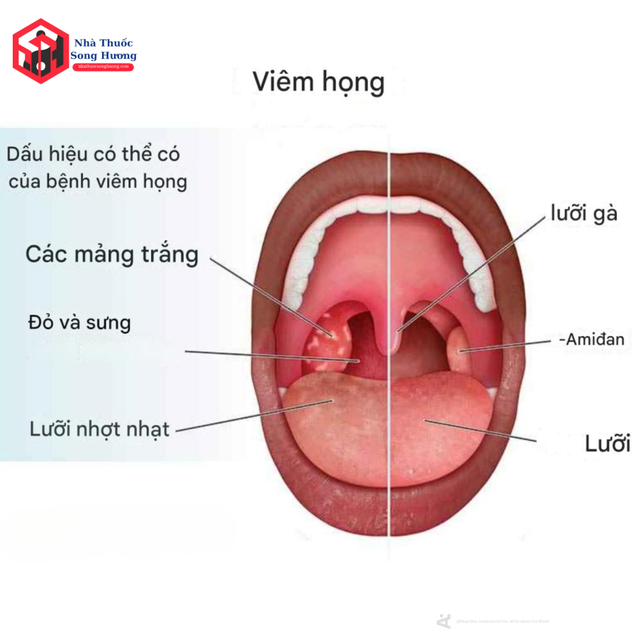 Phân biệt cấp và mạn tính