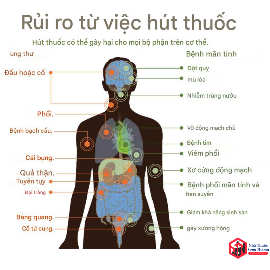 Người hút thuốc dễ bị viêm họng tái phát