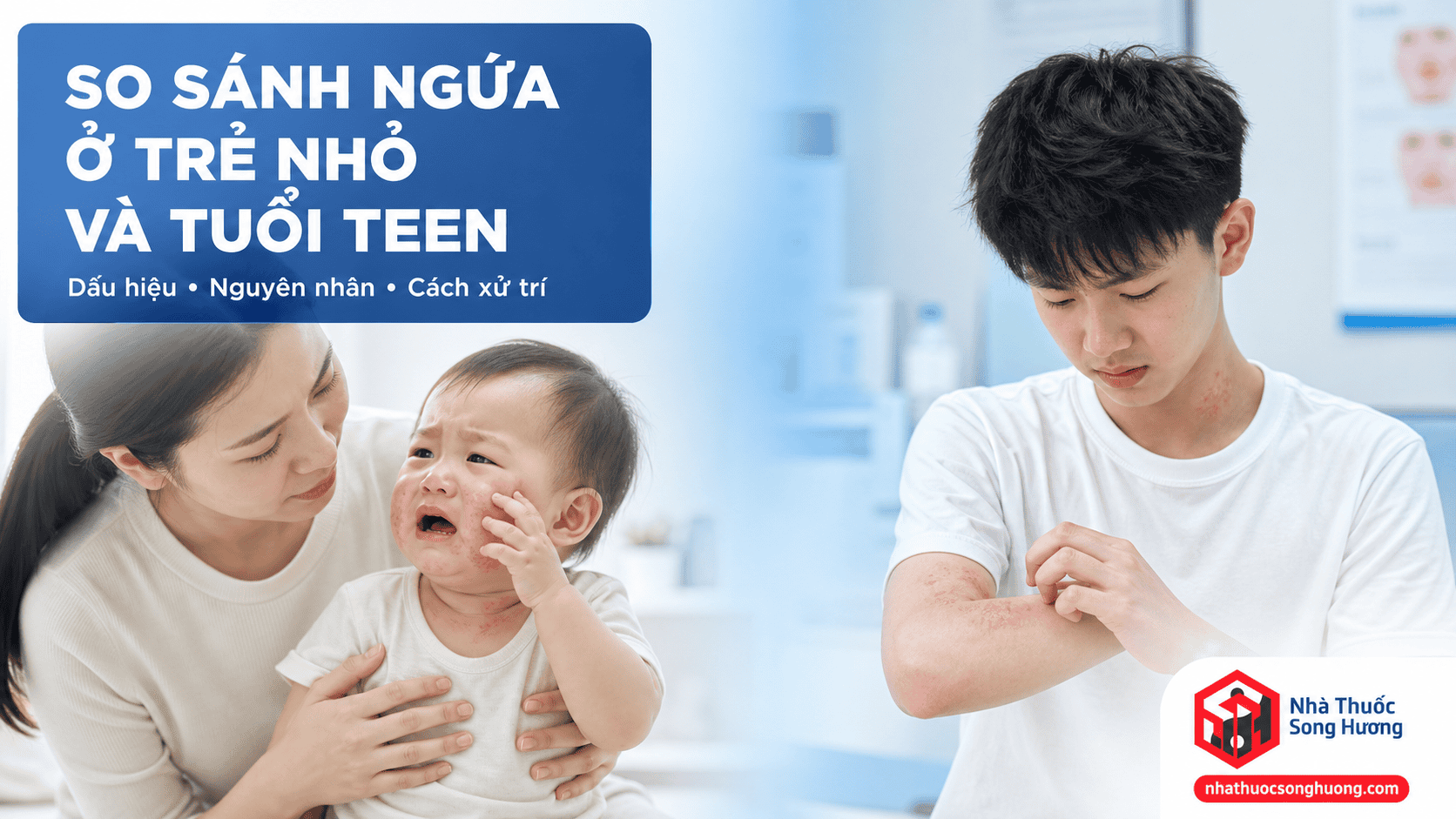 So sánh biểu hiện ngứa ở trẻ chưa biết nói với thanh thiếu niên, minh họa dấu hiệu nhận biết và tổn thương da theo từng độ tuổi.